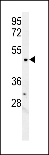 LCLAT1 Antibody