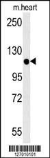 KIF24 Antibody