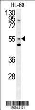 LMAN1L Antibody