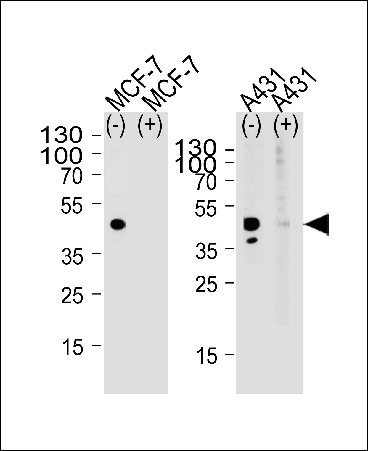 CALCR Antibody