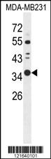 STX7 Antibody