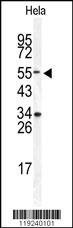 DONSON Antibody