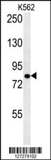 SLC4A7 Antibody