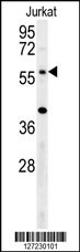 TRIM50 Antibody