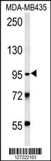 TRHDE Antibody