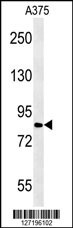 CPEB4 Antibody