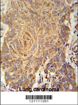 PCYOX1L Antibody