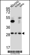 TAF1D Antibody