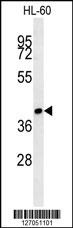 ST8SIA3 Antibody