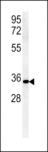 ZDHC2 Antibody