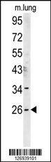DNAJC8 Antibody