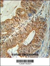 TSPAN3 Antibody