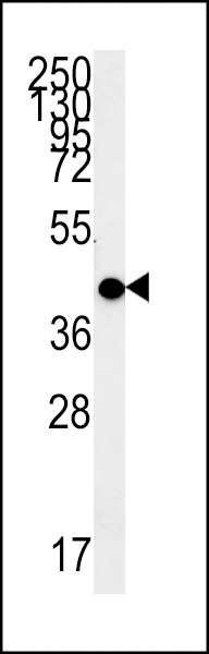 MC2R Antibody