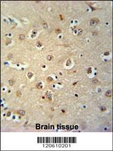 MEIS2 Antibody