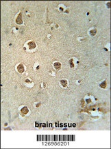 MTCH2 Antibody
