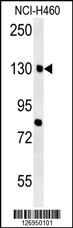 CTTNBP2 Antibody