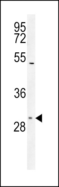 SLC25A1 Antibody