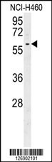 DYNC1LI2 Antibody