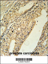 TMEM134 Antibody
