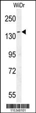 DAAM1 Antibody