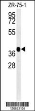 NIPAL2 Antibody