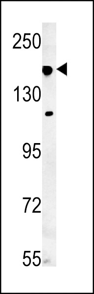 IFT172 Antibody