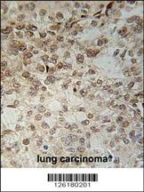 IFT43 Antibody
