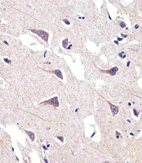 FADS2 Antibody