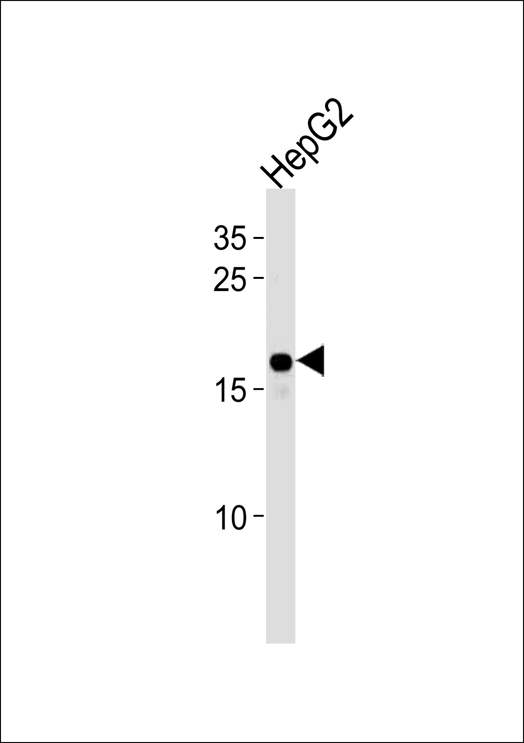 HMGA2 Antibody