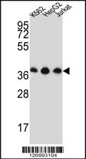 HNRNPDL Antibody