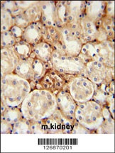 ATP5J2 Antibody