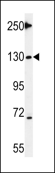 Tnks 2 Antibody
