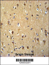 WDR73 Antibody