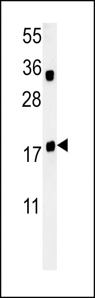 TRAPPC6A Antibody