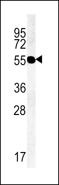 TMEM79 Antibody