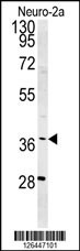 SNRNP40 Antibody