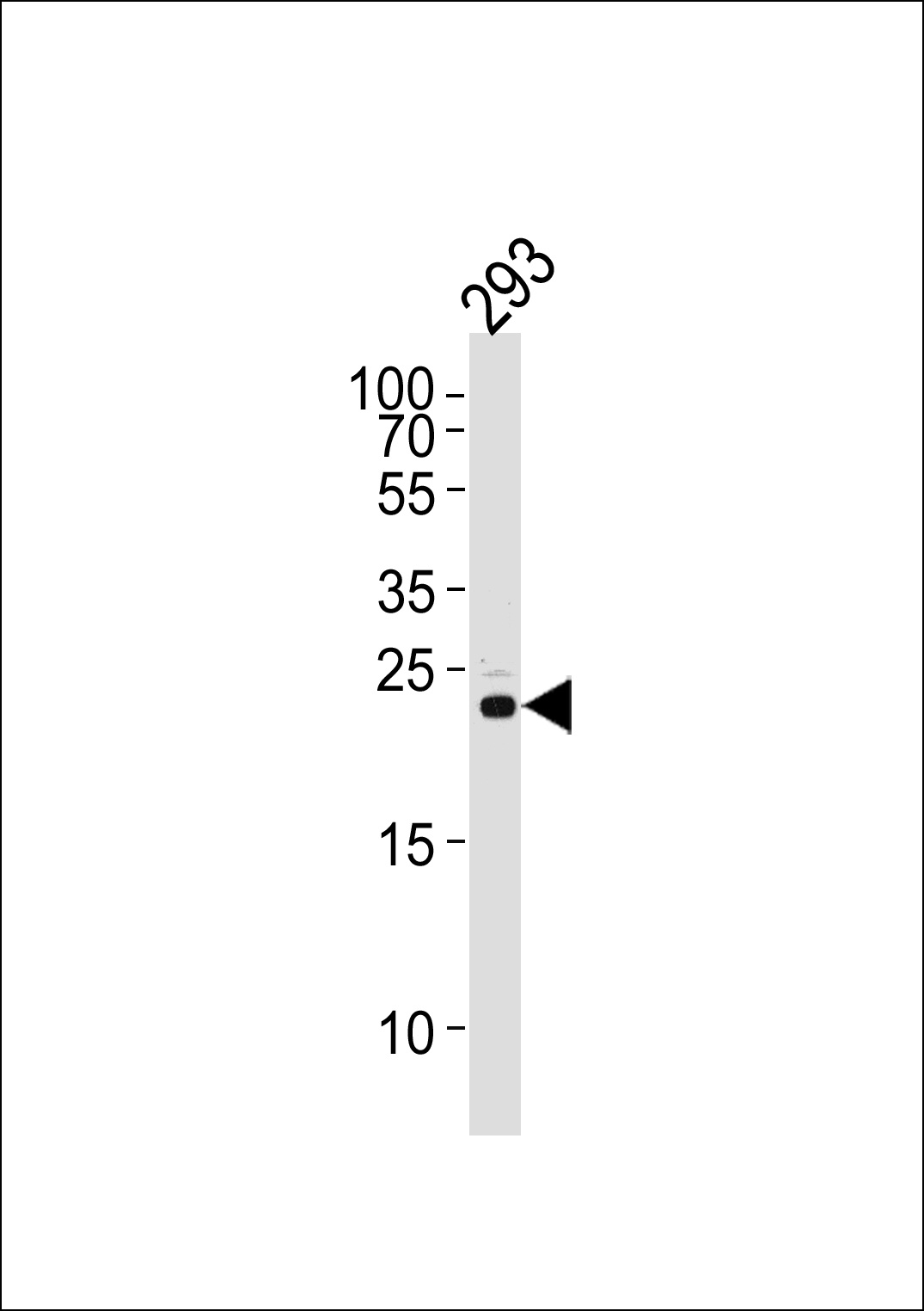 RSPO2 Antibody