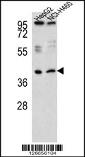 RSAD1 Antibody