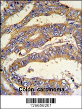 RSAD1 Antibody
