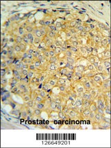 RNASEK Antibody
