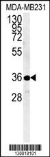 MYOZ1 Antibody
