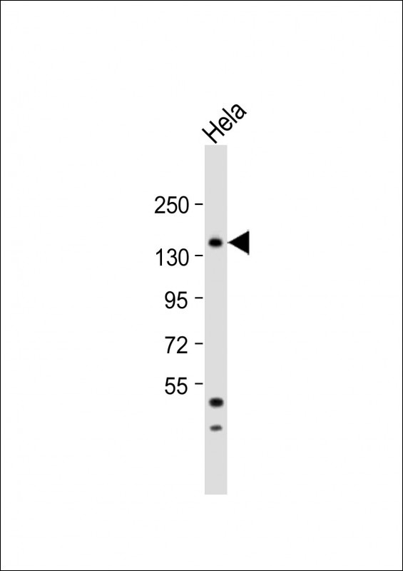 FAN1 Antibody