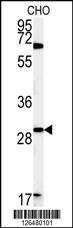 LHFPL2 Antibody