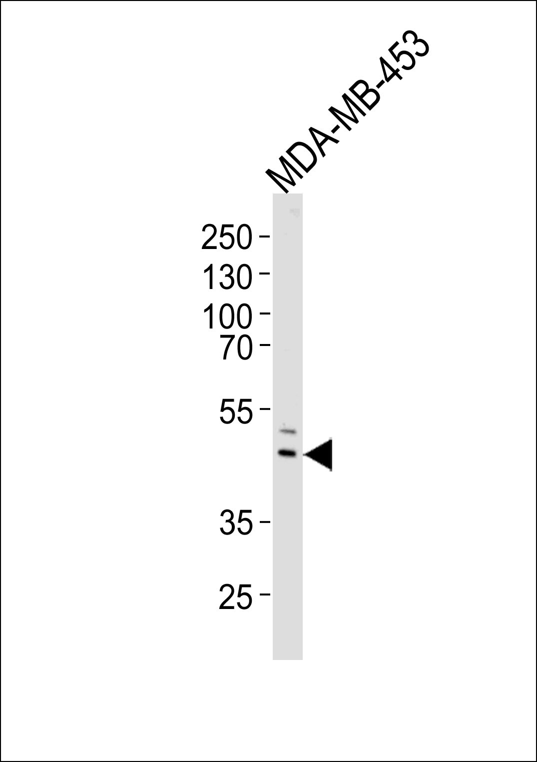 IL5RA Antibody