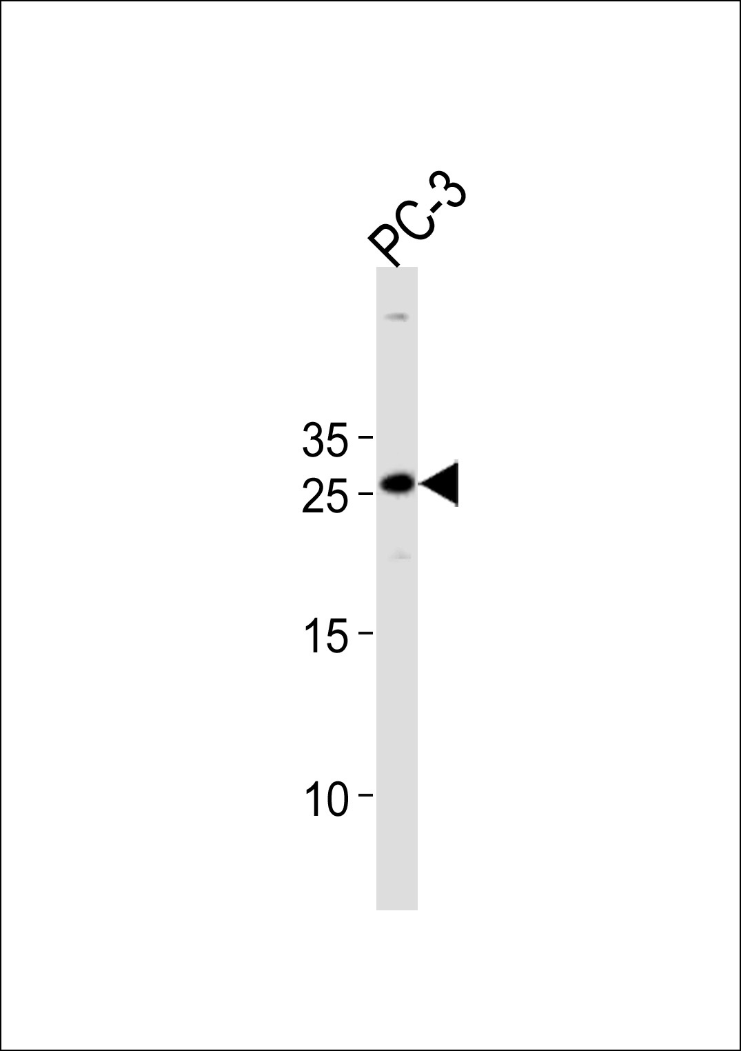 HOXC6 Antibody