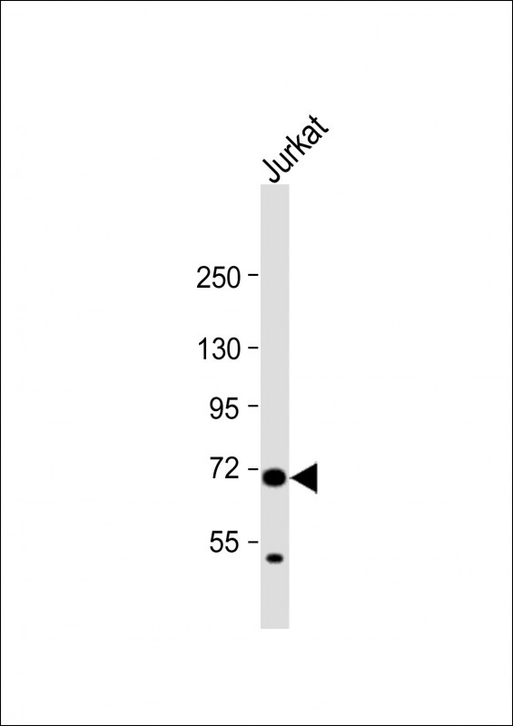 HAUS5 Antibody