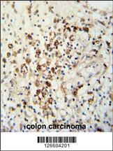 HAUS5 Antibody