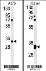 FYTTD1 Antibody