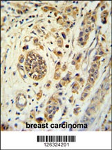 FBXL15 Antibody