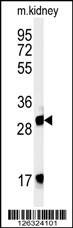 FBXL15 Antibody